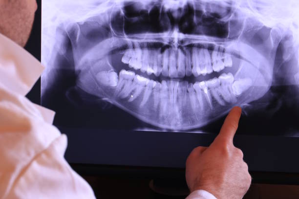 Best Emergency Dental Care for Broken or Chipped Teeth in Augusta, ME